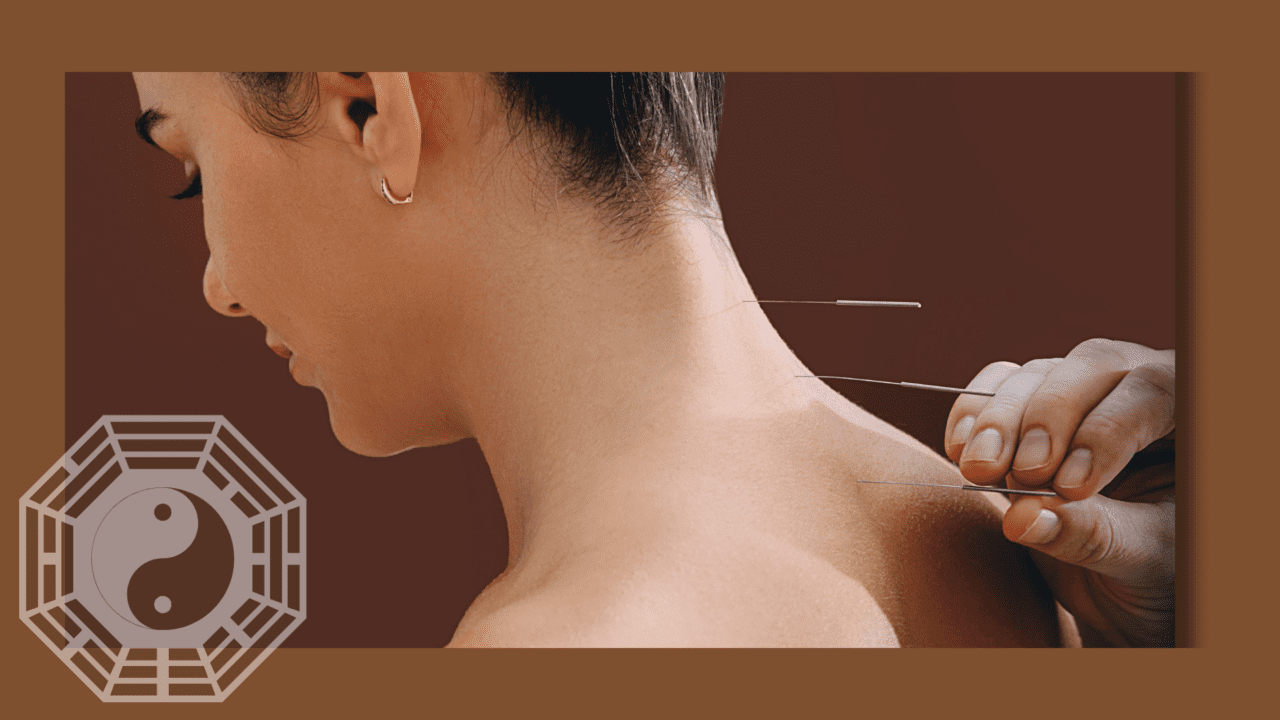 Newcastle Acupuncture Clinic On Point Natural Medicine Newcastle