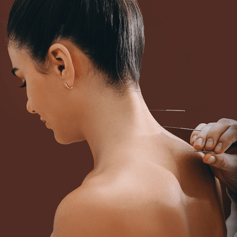 A close-up photo of an acupuncture practitioner's hand holding a needle next to a patient's hand.