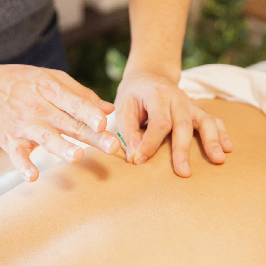 A close-up photo of an acupuncture practitioner's hand holding a needle next to a patient's hand.