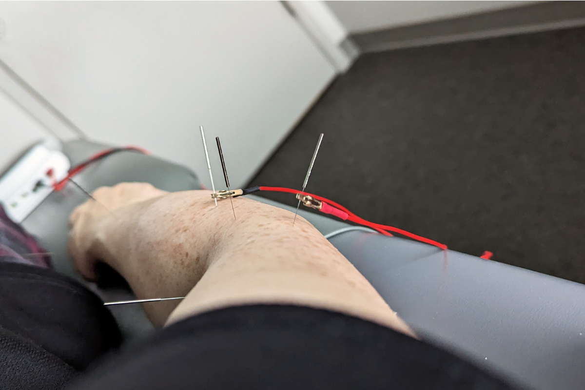 electro acu (1)